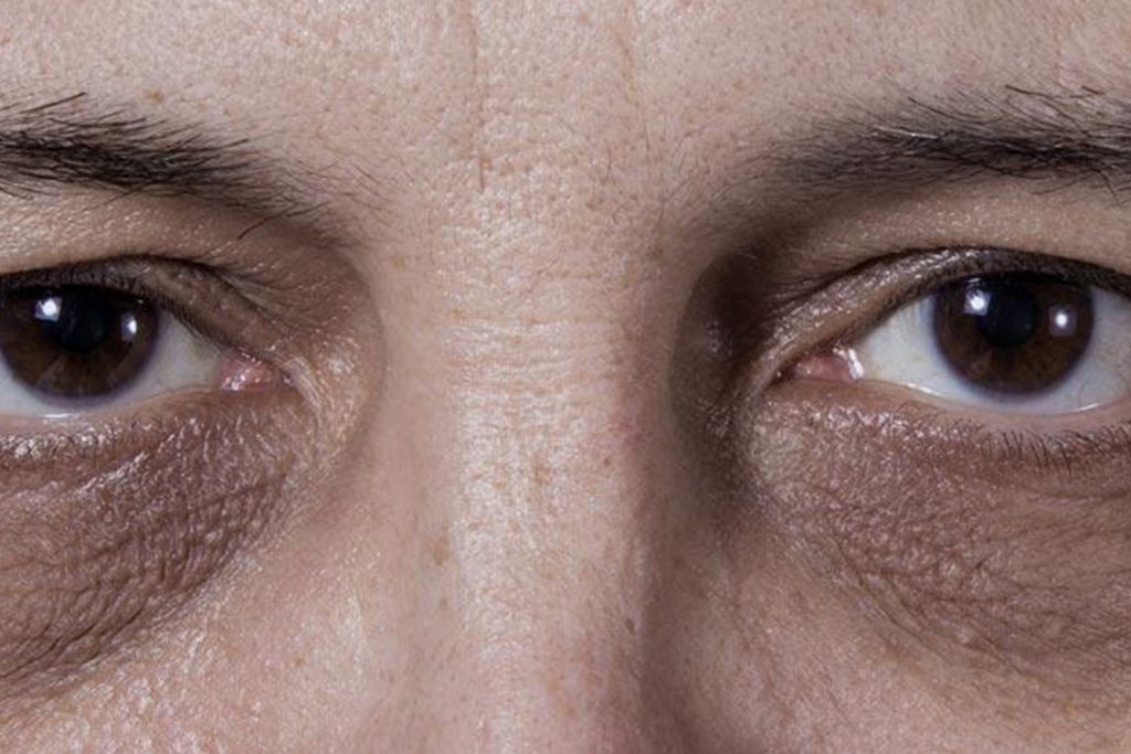 7 tips y trucos para quitar las ojeras en hombres - Métodos Para Ligar